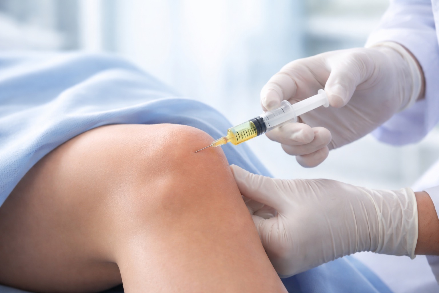 Plättchenreiches Plasma (PRP)
